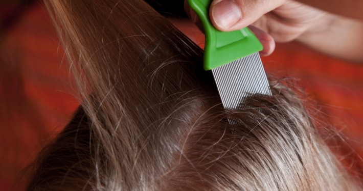 Link naar Luis in je haar? Kammen maar!